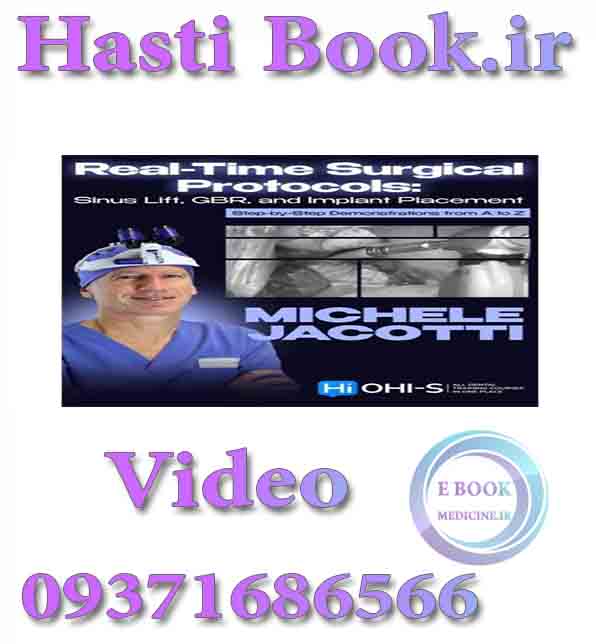Real-Time Surgical Protocols: Sinus Lift, GBR, and Implant Placement. Step-by-Step Demonstrations from A to Z (Videos) 2026 (2)