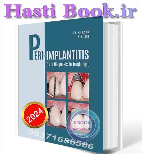 دانلود کتاب Peri-Implantitis: From Diagnosis to Treatment 2024 (PDF)