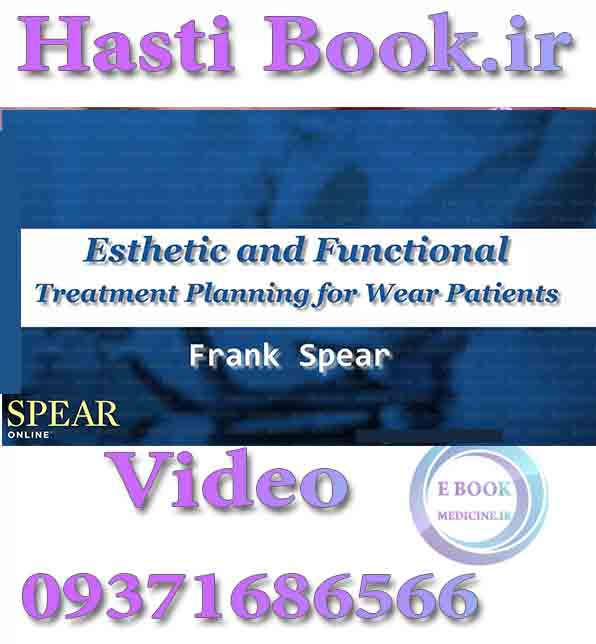فیلم video SPEAR Esthetic and Functional Treatment Planning for Wear Patients - Frank Spear