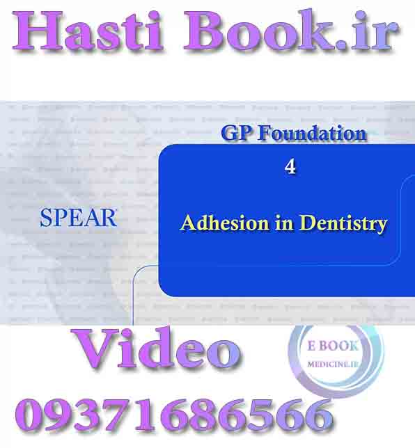 فیلم video  SPEAR GP Foundation 4, Adhesion in Dentistry