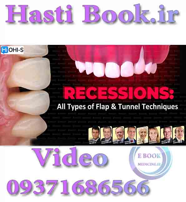 فیلم OHI-S Recessions All Types of Flap & Tunnel Techniques 2
