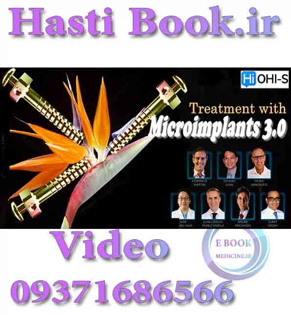 فیلم  OHI-S Treatment with Mcroimplants 3.0