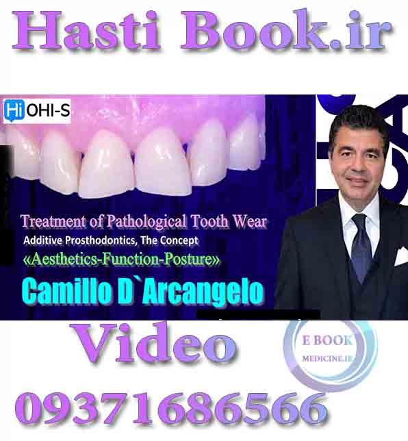 فیلم OHI-S Treatment of Pathological Tooth Wear - Camillo D`ArcangeloAdditive Prosthodontics. The Concept «Aesthetics-Function-Posture»