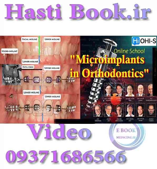 فیلم OHI-S Online School Microimplants in Orthodontics