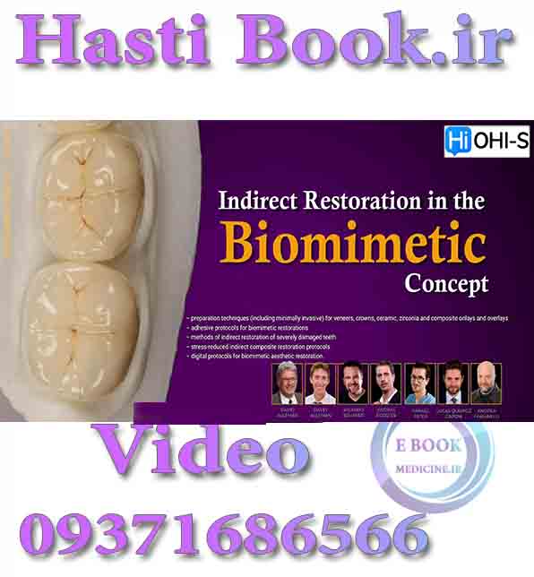 فیلم  OHI-S Indirect Restoration in the Biomimetic Concept