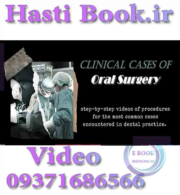 فیلم  Clinical Cases of Oral Surgery
