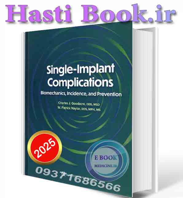 دانلود کتاب Single-Implant Complications Biomechanics, Incidence, and Prevention 2025 ( PDF)
