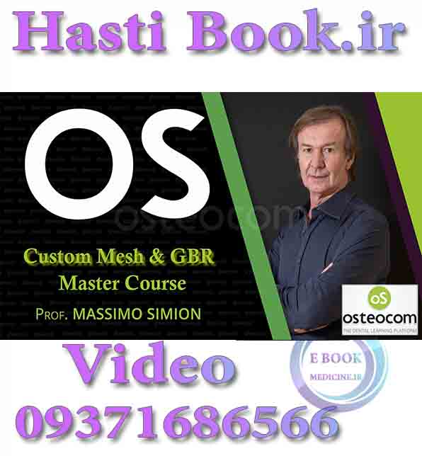 فیلم Osteocom Custom Mesh & GBR Master Course, New Trends in Regeneration - Massimo Bone regeneration of severe vertical and horizontal defects and soft tissue management Simion (2)