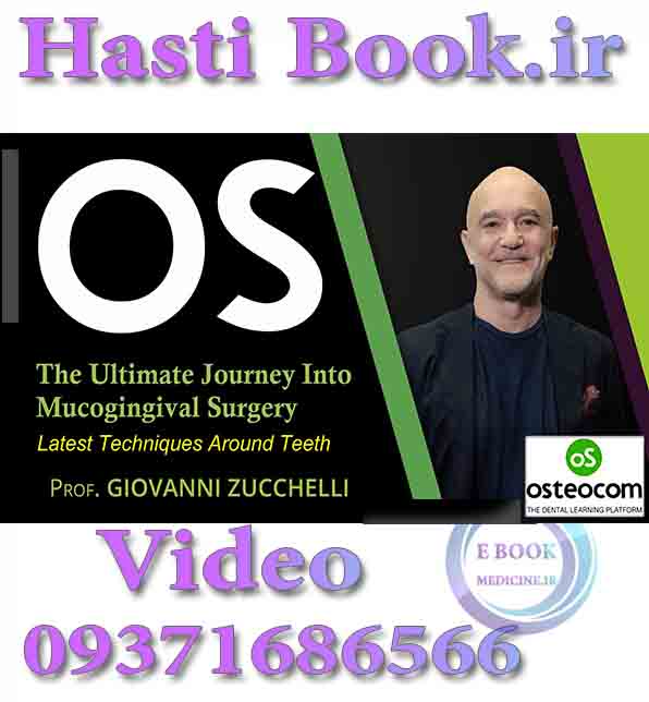 فیلم Osteocom The Ultimate Journey into Mucogingival Surgery, Latest Techniques Around Teeth - Giovanni Zucchelli (2)