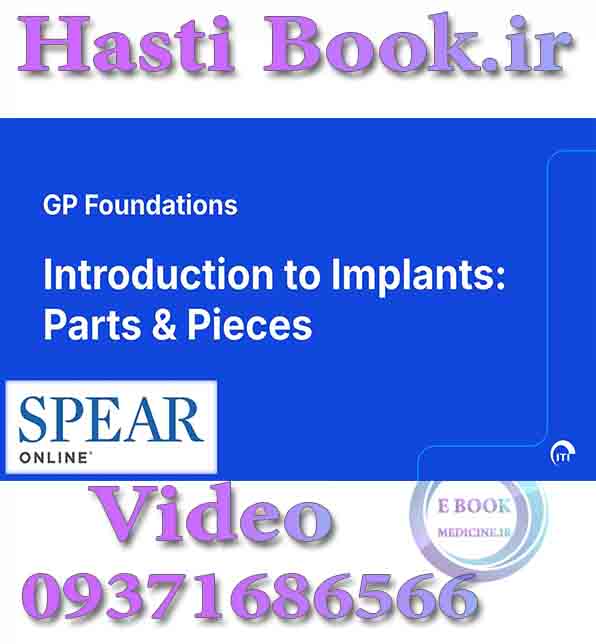 فیلم  SPEAR Introduction to Implants Parts & Pieces (2)