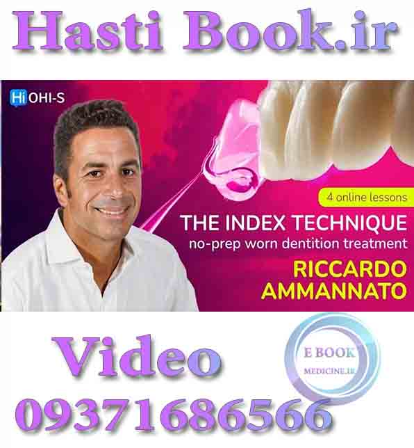 فیلم OHI-S The INDEX Technique, No Prep Worn Dentition Treatment - Ricardo Ammannato (2)