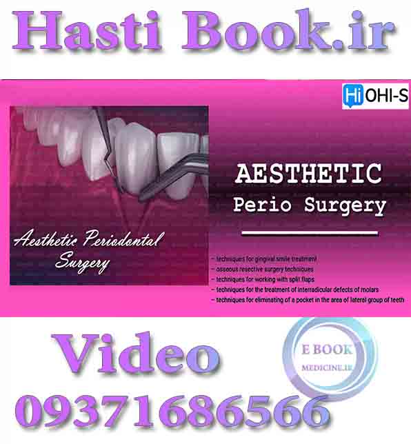 فیلم OHI-S Aesthetic Periodontal Surgery (2)