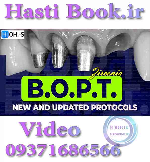 فیلم  OHI-S Zirconia BOPT, New and Updated Protocols (2)