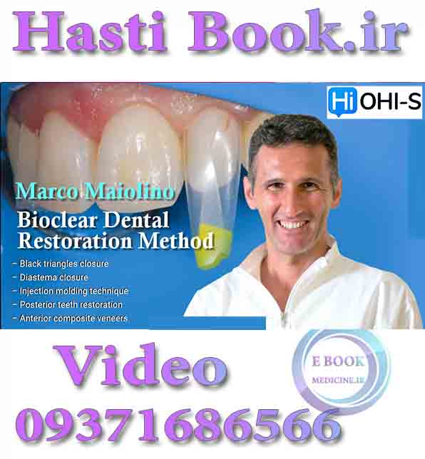 فیلم  OHI-S Bioclear Dental Restoration Method - Marco Maiolino (2)