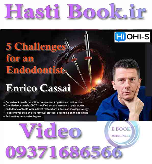 فیلم OHI-S 5 Challenges for an Endodontist - Enrico Cassai (2)