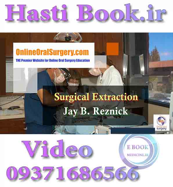 فیلم OnlineOralSurgery Surgical Extraction - Jay B. Reznick video) (2)