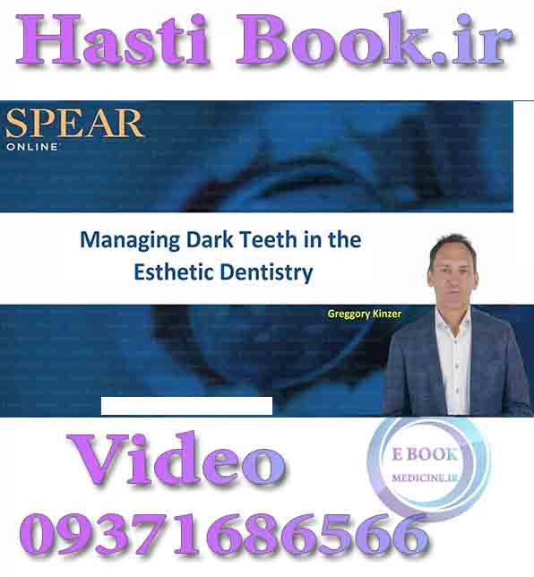 فیلم Spear Managing Dark Teeth in the Esthetic Dentistry - Greggory Kinzer video (2)