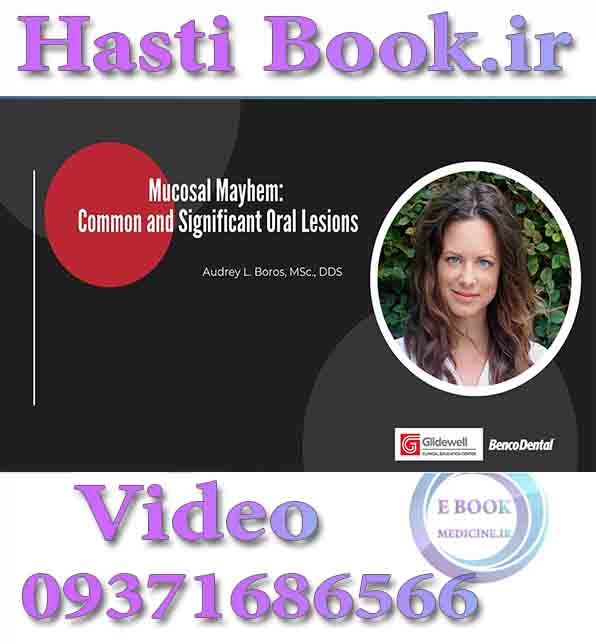 فیلم Glidewell Mucosal Mayhem, Common and Significant Oral Lesions - Audrey L. Boros video (2)
