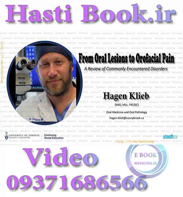 فیلم Utooth From Oral Lesions to Orofacial Pain, A Review of Commonly Encountered Disorders - Hagen Klieb video (2)