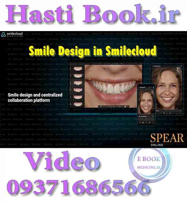 فیلم Spear Smile Design in Smilecloud video (2)
