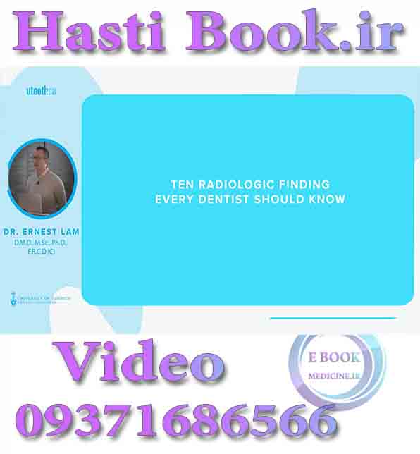 فیلم Utooth Ten Radiologic Finding Every Dentist Should Know - Ernest Lam video (2)