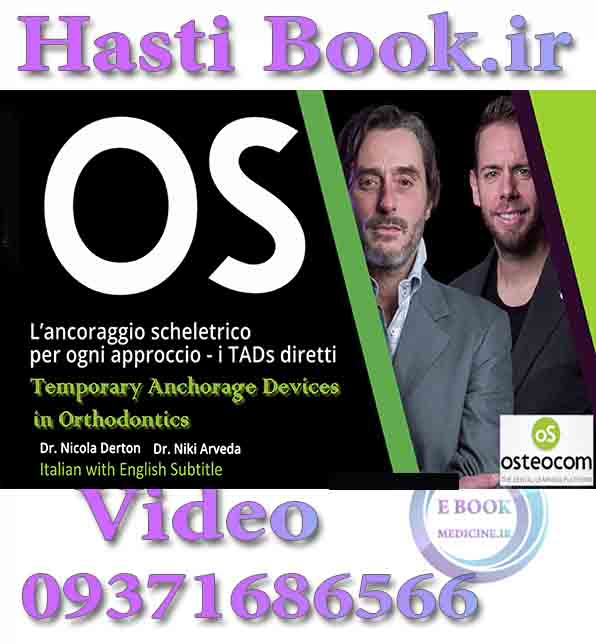 فیلم Osreocom Temporary Anchorage Devices in Orthodontics - Nicola Derton, Niki Arveda L'ancoraggio Scheletrico per ogni approccio, i TADs diretti video