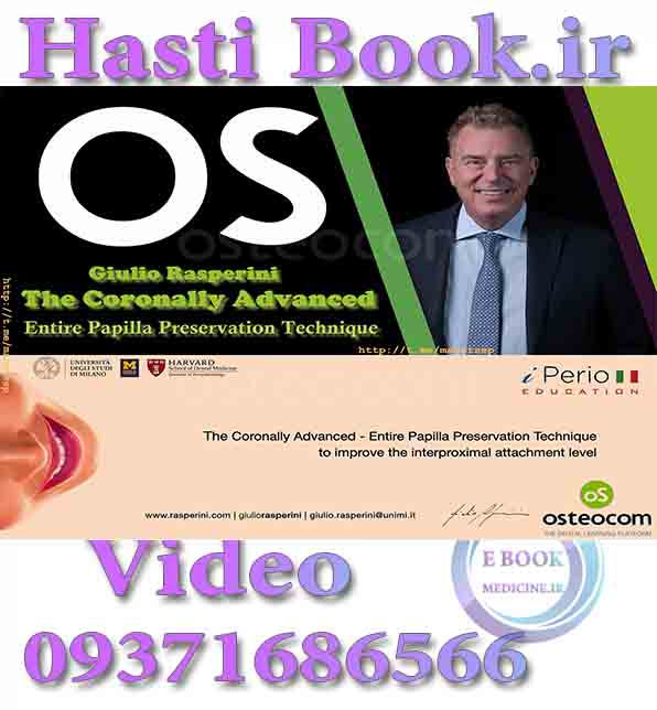 فیلم Osteocom The Coronally Advanced Entire Papilla Preservation Technique - Giulio Rasperini video (2)