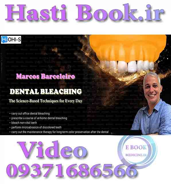 فیلم OHI-S Dental Bleaching - Marcos Barceleiro The Science Based Techniques for Every Day (2)