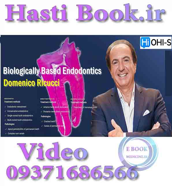 فیلم OHI-S Biologically Based Endodontics - Domenico Ricucci video (2)