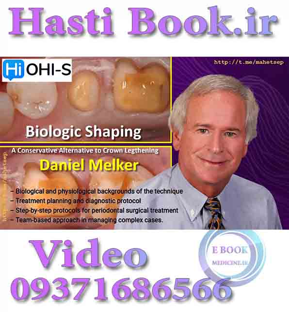 فیلم OHI-S Biologic Shaping - Daniel Melker A Conservative Alternative to Crown Lengthening  video (2)