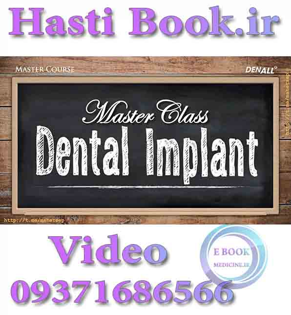 فیلم DenAll MasterCass Dental Implant Korean with English Narration video (2)